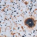 Macfallite inclusions in Quartz